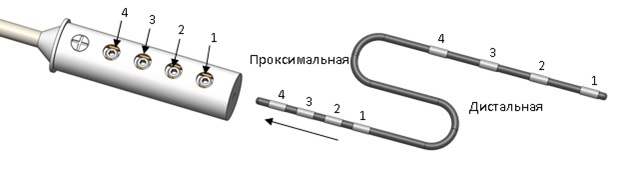 Нейростимулятор імплантований НейСі-3М.ТС